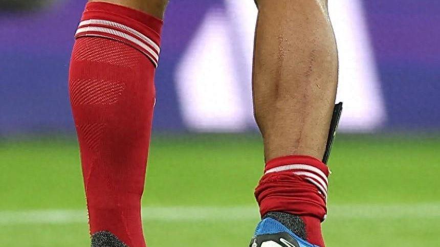 范戴克腿上伤痕触目惊心，怒斥对手：不罚下就没天理了